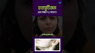 হারসুটিজম এর লক্ষণ এবং কারণসমুহ । Hirsutism [upl. by Simdars]