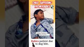 Child suffering from rabies from rabid dog bite [upl. by Needan]