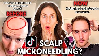 Can You Grow Back Hair With Scalp Microneedling Does Scalp Microneedling Work [upl. by Amlus]