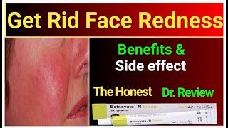 How to use betnovate n cream  benefits and side effects  Dr review betnovate cream [upl. by Alleuqcaj]