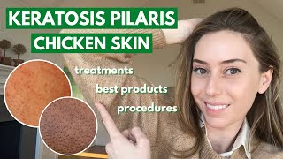 Keratosis Pilaris How to treat dry bumpy skin aka chicken skin  Dr Shereene Idriss [upl. by Akemor991]