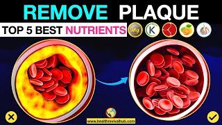 THE Nutrients to Remove Calcium Plaque from Arteries [upl. by Oza949]