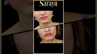 Lip amp Jawline Enhancement Magic  Sarayu Clinics fillers beauty [upl. by Haidebej440]