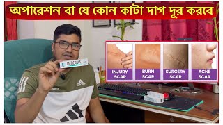 Mederma Advanced Scar Removal Gel  সার্জারির দাগ দ্রুতগতিতে দূর করে যে ক্রিম  Scar Removal Cream [upl. by Nnylarac]