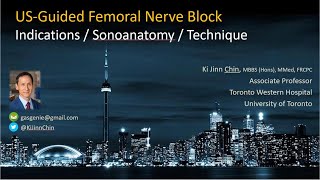 Ultrasoundguided Femoral Nerve Block [upl. by Raamal470]