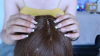 ASMR  Dandruff Removal amp Scalp Check Extremely Satisfying [upl. by Einnaffit]