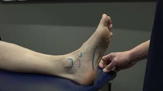 Foot and Ankle 2  Plantar Fascia and Spring Ligament Palpation [upl. by Leibman]