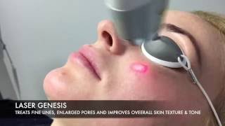 Laser Genesis Facial [upl. by Urbanna]