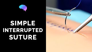 Simple interrupted suture wound suturing  OSCE Guide  UKMLA  CPSA [upl. by Vas]