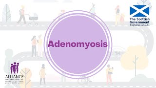 Living with adenomyosis [upl. by Gaston287]