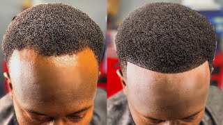 HOW TO FIX A BALDING RECEDING HAIRLINE  PERFECT HAIRCUT FIX [upl. by Featherstone]