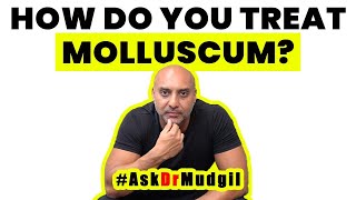 HOW DO YOU TREAT MOLLUSCUM [upl. by Rob]