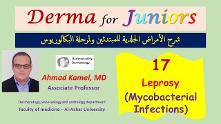 017 Leprosy Mycobacterial Infections د أحمد كامل [upl. by Leirrad]