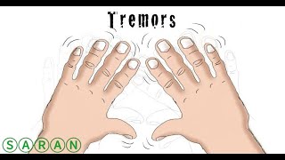 Types of tremors [upl. by Tam]