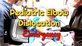 Pediatric Elbow Dislocation How to Recognize and Treat [upl. by Karlyn806]