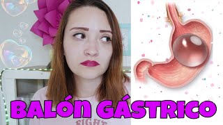 Me puse el balón gástrico  No lo aguanté  estába gorda  Storytime [upl. by Linnet]