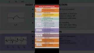 ECG Interpretation [upl. by Gustavus925]