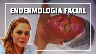 REVITALIZAÇÃO FACIAL COM ENDERMOLOGIA  Protocolo Prático de Estética Profissional [upl. by Odnumyer]