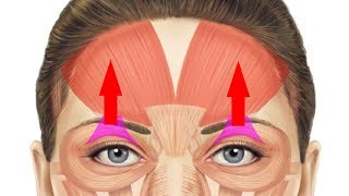 How To Cure SaggingDrooping Eyelids Naturally Super Fast [upl. by Lyndes]