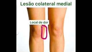 Lesão do ligamento colateral medial do joelho  torção do joelho  lesão ligamentar [upl. by Ikcin]