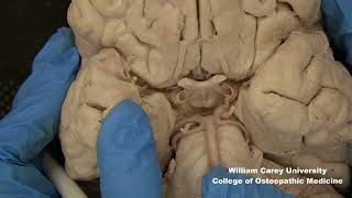 Ventral brainstemhypothalamus neuroanatomy hypothalamus brainstem anatomymedicalstudentbrain [upl. by Sinned]