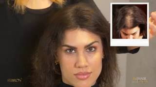 Thinning Hair In Women Solution Testimonial  Febron FREE SAMPLE [upl. by Skrap]