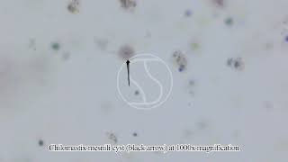 Chilomastix mesnili Cyst under the microscope [upl. by Thomson658]