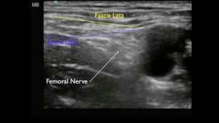 Femoral Nerve anatomy [upl. by Calla]