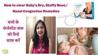 How to Treat Nasal congestionStuffy nose in Babies  Nasobuddy Nasal Aspirator Blocked nose [upl. by Alleunam488]