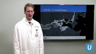 Superior Semicircular Canal Dehiscence  Quinton Gopen MD  UCLAMDChat [upl. by Eiral]