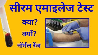 सीरम एमाइलेज टेस्ट Amylase test एमाइलेज़ की नॉर्मल रेंज amylase normal range [upl. by Klingel538]