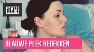 Blauwe plekken bedekken  FEMME [upl. by Odnomor416]