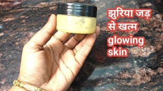 झुरियां खत्म कर चेहरा मुलायम चमकदार बनाएं  soft glowing skin  Dry skin cream [upl. by Jamin]