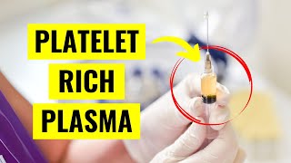 Platelet Rich Plasma PRP Injections Everything You Need to Know [upl. by Elacim]