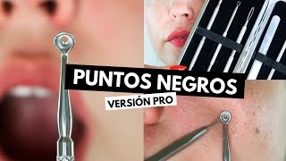 ¡LA SOLUCIÓN DEFINITIVA Elimina PUNTOS NEGROS y POROS ABIERTOS CON ESTO  Pretty and Olé [upl. by Kcoj]