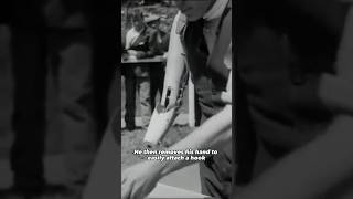 Prosthetic arm demonstration in 1921 history [upl. by Leede]