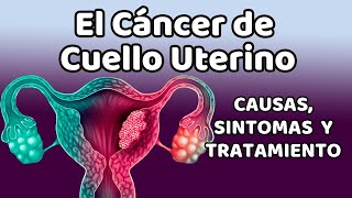 CÁNCER DE CUELLO UTERINO Causas signos y síntomas diagnóstico y tratamiento [upl. by Nylareg122]