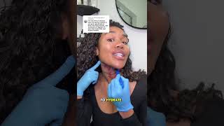 Neck tightening WITHOUT surgery neck looseskin antiagingtreatments [upl. by Ettevroc]