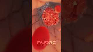 Venous thromboembolism  Deep vein thrombosis DVT  thrombosis medicalanimation bloodclot [upl. by Rozina314]