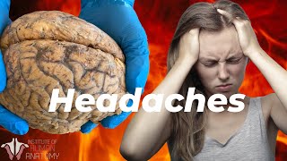 What is Causing Your Headaches [upl. by Navert]