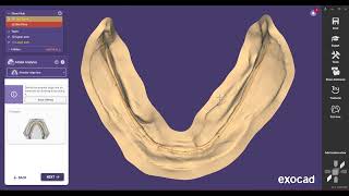 Designing complete dentures with Exocad Denture Module [upl. by Wardlaw228]