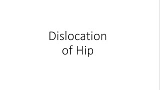 Dislocation of Hip  Orthopedics [upl. by Bazar]