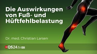 Knieprobleme vermeiden Die Bedeutung von Fuß und Hüftausrichtung  Dr Christian Larsen  QS24 [upl. by Norred]