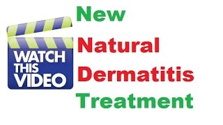 Stasis dermatitis treatment Dermatology doctor Dermatology specialist [upl. by Bundy]