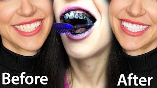 Fastest Way To Whiten Teeth At Home What REALLY Works [upl. by Anyalram]