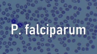 Plasmodium falciparum [upl. by Lobell]