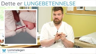 Dette er LUNGEBETENNELSE  Lommelegen  Lungesykdommer [upl. by Lleda]