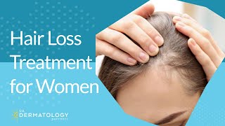 Hair Loss Treatment for Women [upl. by Lertnek328]