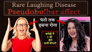 Pseudobulbar affect Rare Laughing Disease क्या है कैसे होती है इलाज है या नहीं  घंटो हसना रोना [upl. by Zacharia]