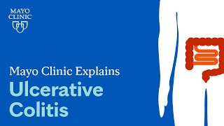 Mayo Clinic Explains Ulcerative Colitis [upl. by Elleuqar438]